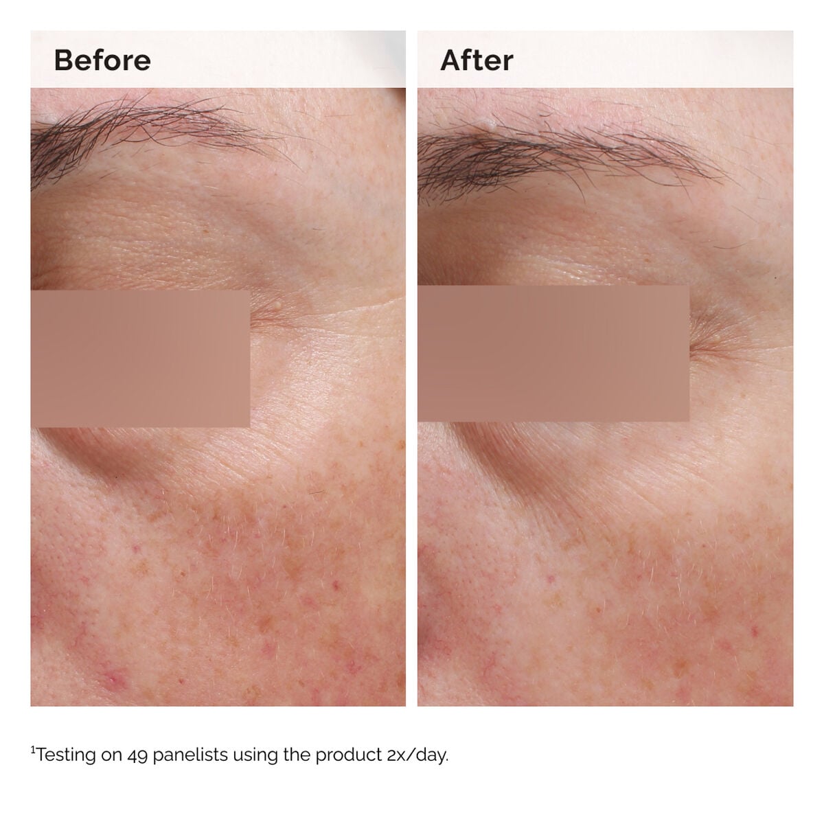 niacinamide-5-face-and-body-emulsion-v4 2024-08-23-ORD-Nia-5pct-Face-Body-B-A-Elasticity-Global-02-1x1.jpg