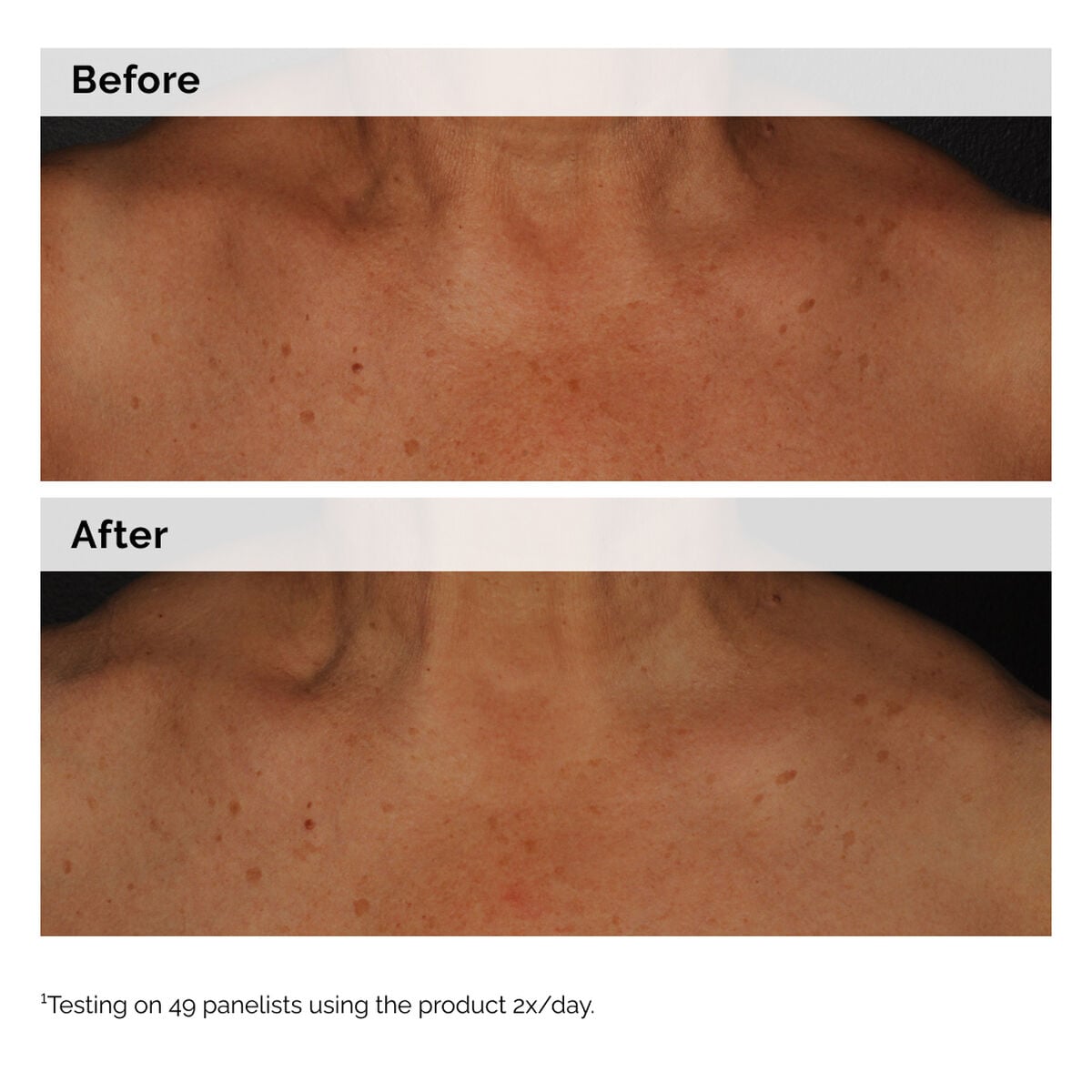 niacinamide-5-face-and-body-emulsion-v4 2024-08-23-ORD-Nia-5pct-Face-Body-B-A-Global-02-1x1.jpg