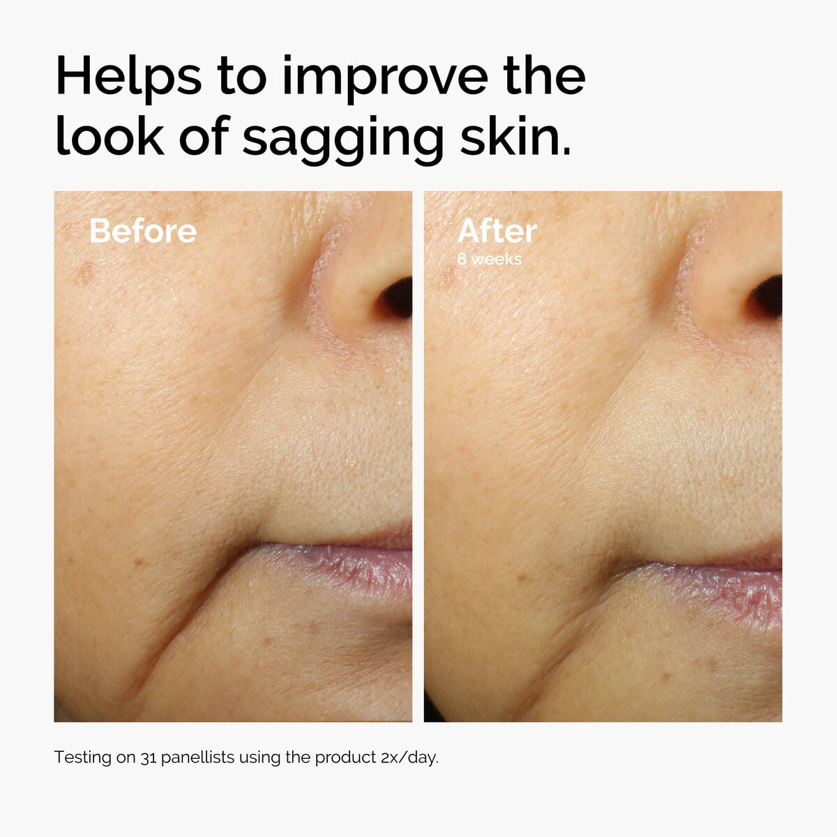 caffeine-3-escin-1-face-serum-t3 ord-caffeine-3pct-escin-1pct-face-serum-before-after-sagging.jpg