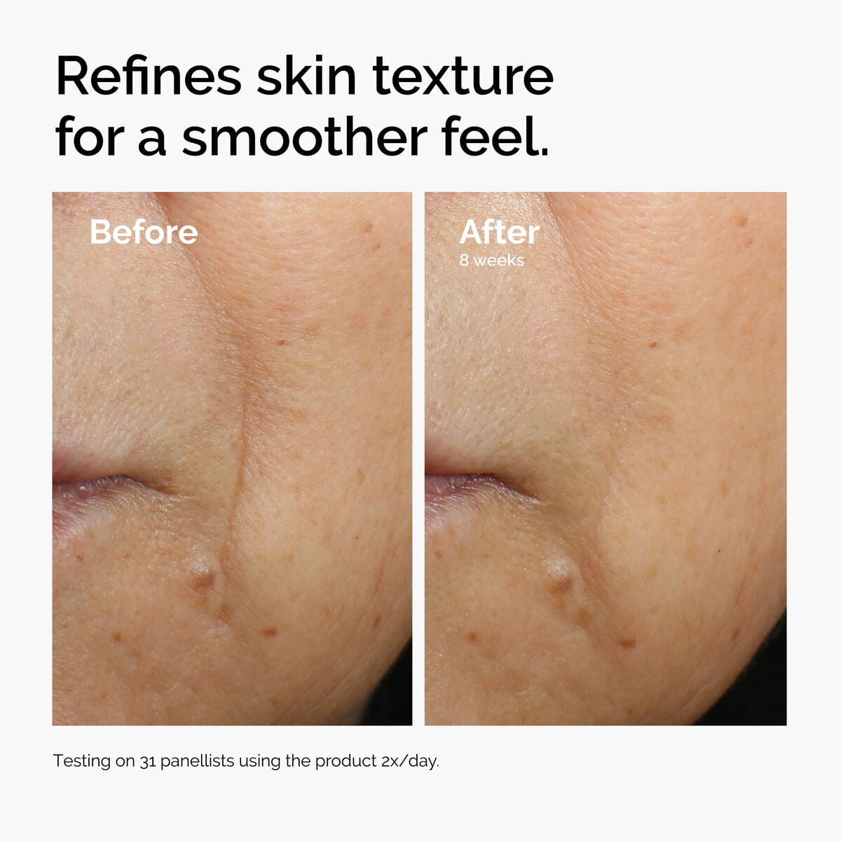caffeine-3-escin-1-face-serum-t3 ord-caffeine-3pct-escin-1pct-face-serum-before-after-texture.jpg