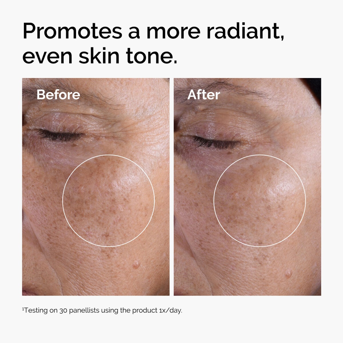 glycolic-acid-7-exfoliating-toner-j1 ord-glycolic-before-after-radiance.jpg