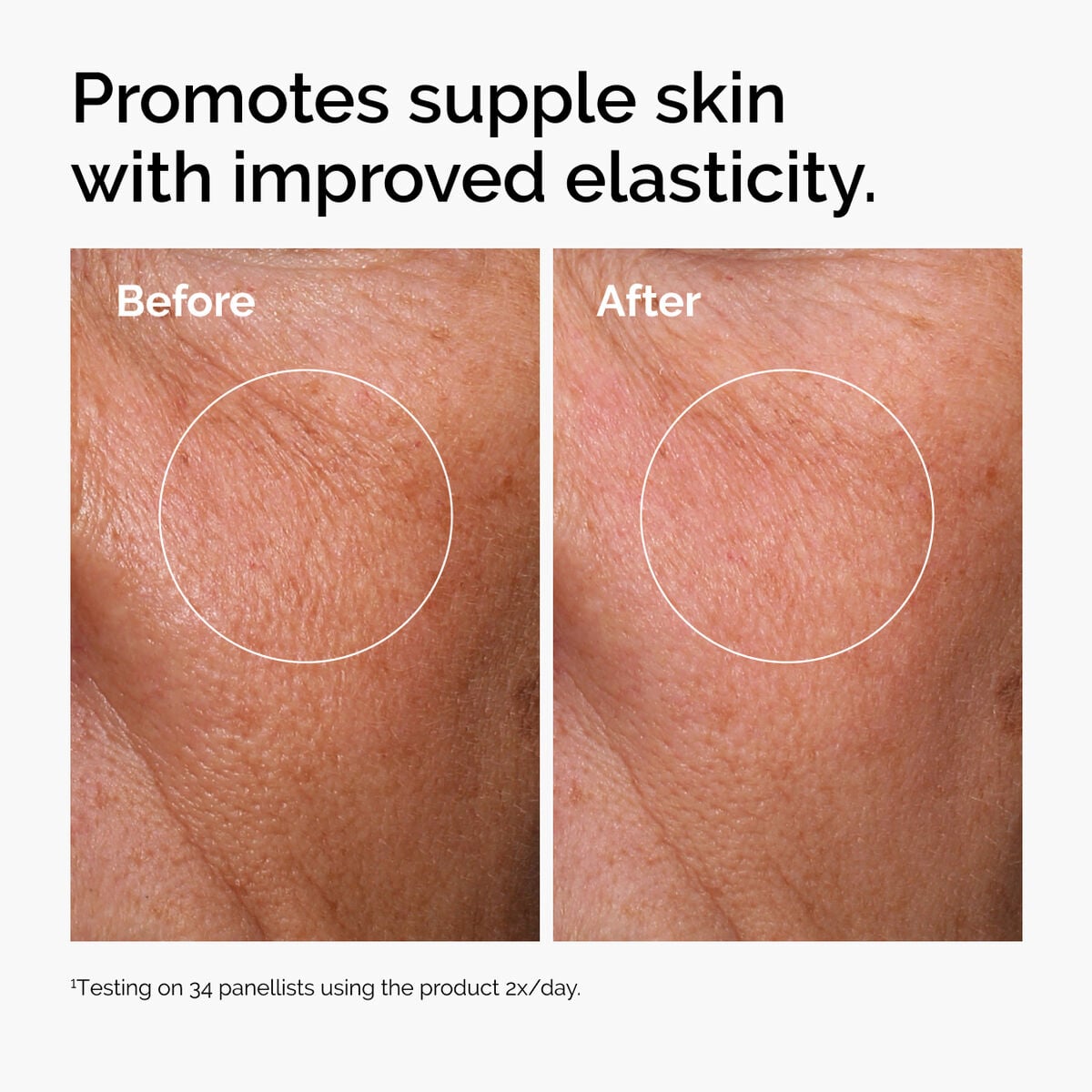 hyaluronic-acid-2-b5-with-ceramides-i2 ord-hyaluronic-acid-2pct-b5-hydrating-serum-before-after-elasticity.jpg
