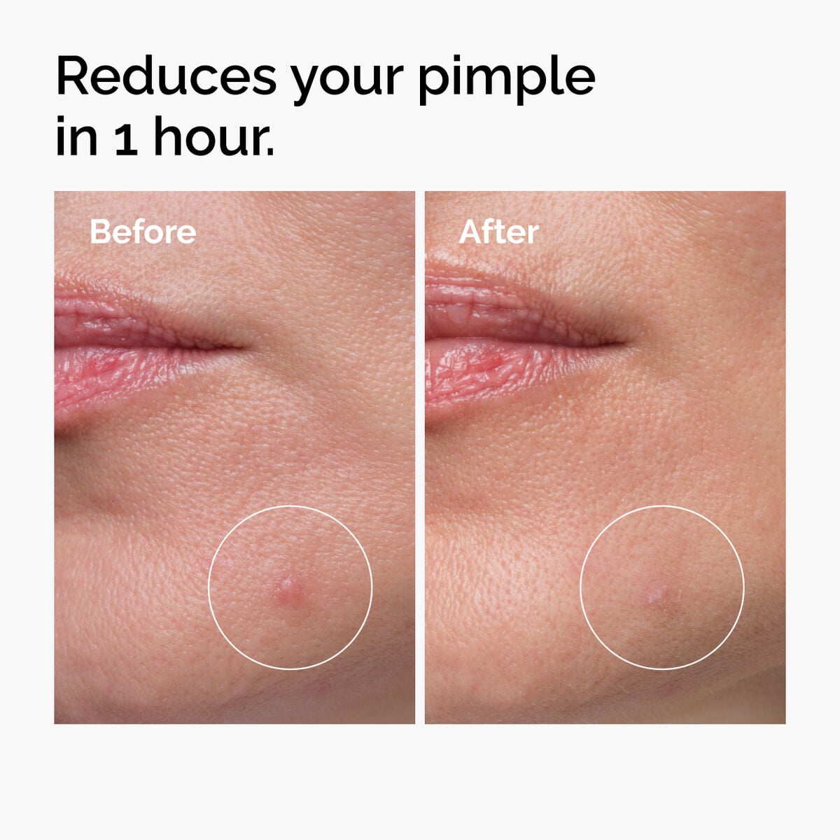 sulfur-10-powder-to-cream-concentrate-a4 ord-sulfur-10pct-powder-to-cream-concentrate-before-after-NA.jpg