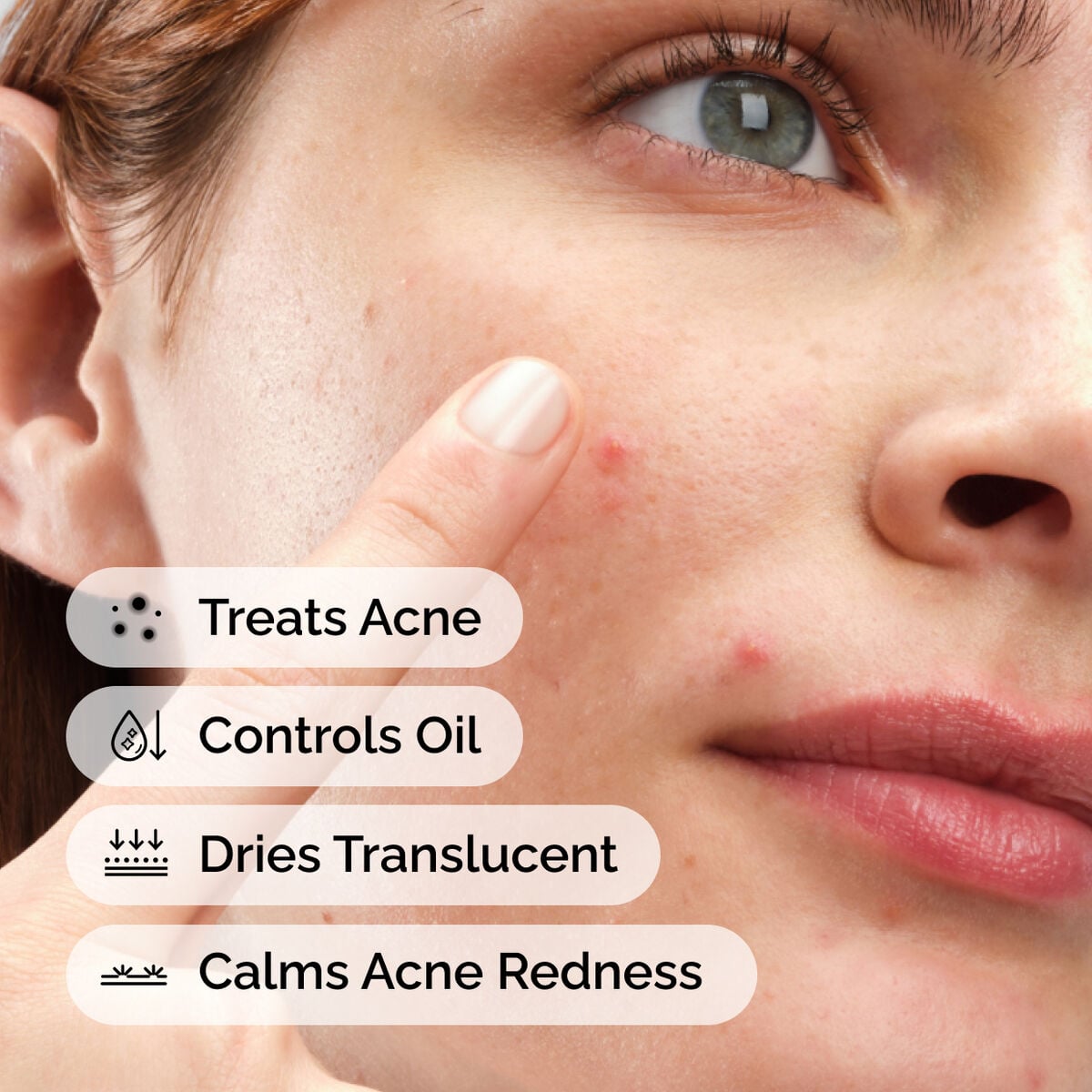 sulfur-10-powder-to-cream-concentrate-a4 ord-sulfur-10pct-powder-to-cream-concentrate-model-application-with-benefits-acne.jpg